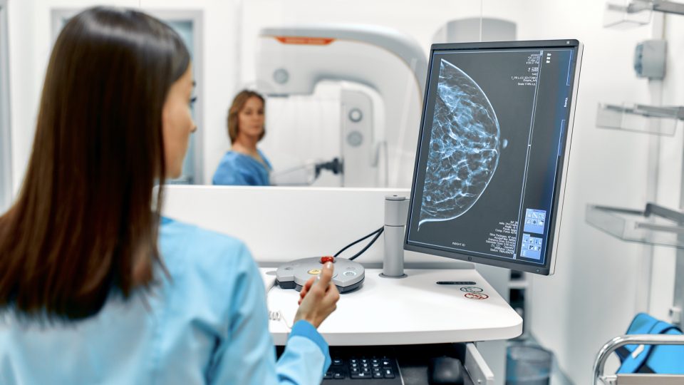 How to Balance the Risks and Benefits of Mammograms