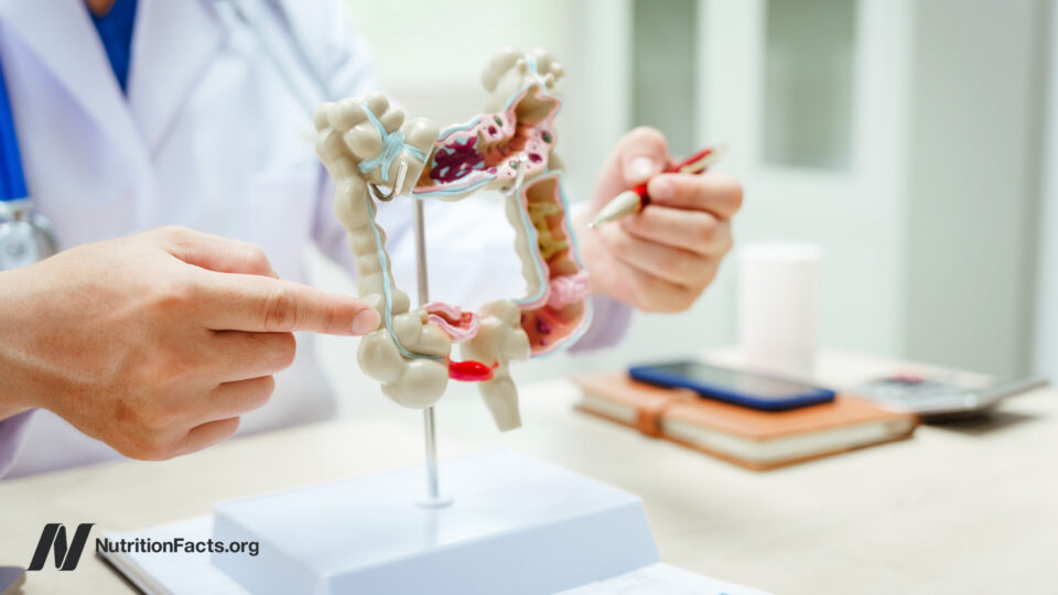 The Validity of SIBO Tests 