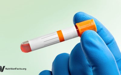 Ideal vs. Normal Cholesterol Levels