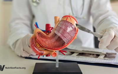 The Hidden Costs of Bariatric Surgery