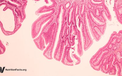 Could Bovine Leukemia Virus be a Cause of Breast Cancer?