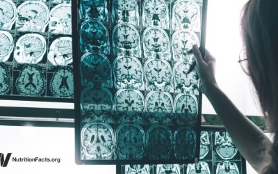 A Persistent Pesticide Is Linked to Alzheimer’s Risk