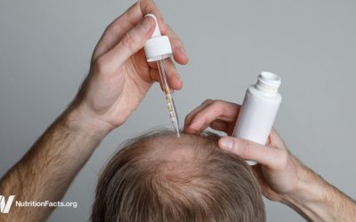 The Benefits and Risks of Hair Loss Drugs